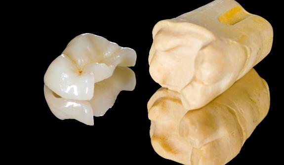 Model tooth with metal free dental restoration