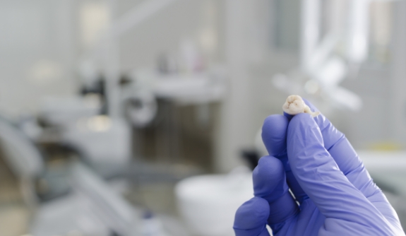 Dentist holding tooth after extraction