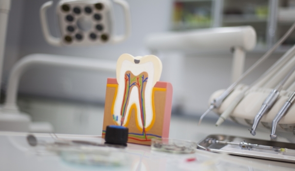 Model of the inside of a tooth used to describe root canal therapy