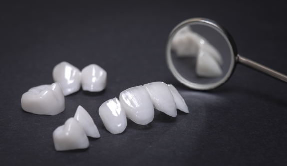 Porcelain veneers and other dental restorations on tabletop