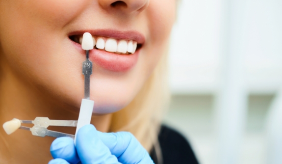 Woman's smile compared with tooth color chart